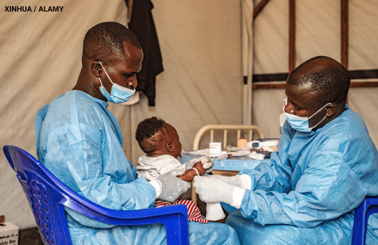 A child is treated for mpox