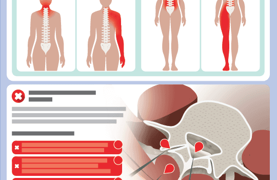 Spinal pain graphic