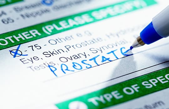 Prostate test