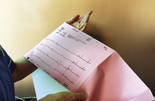 Electrocardiography test results